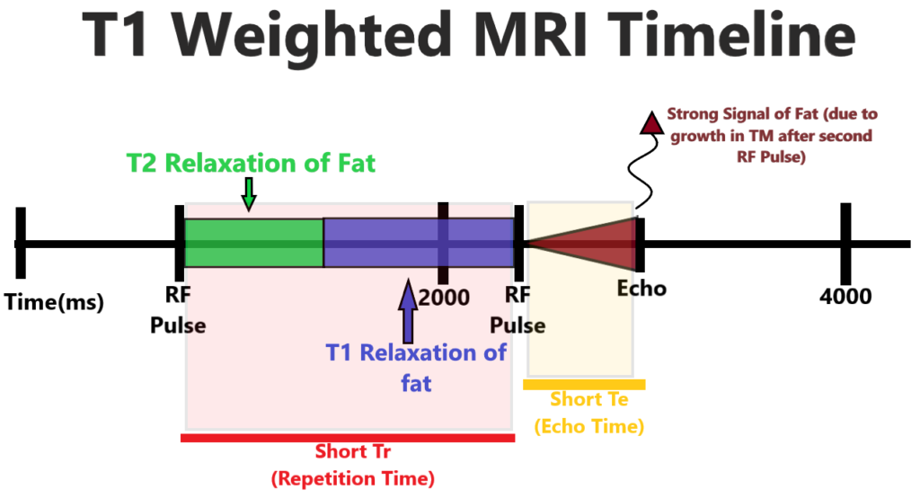 T1 weighted MRI timeline